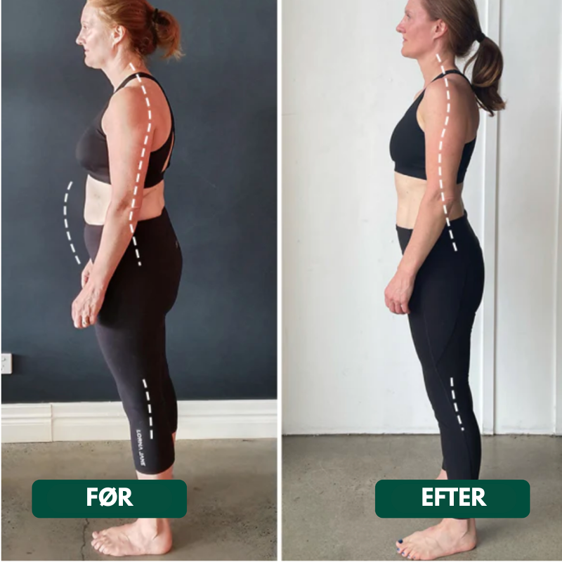 RygStöd™ – Förbättra din hållning och lindra ryggsmärta