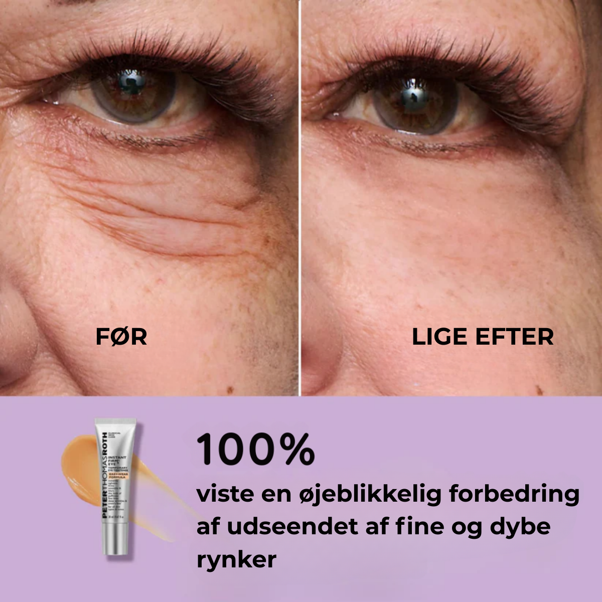 ØjenLys™ Snabb Utjämnare för Ögonområdet