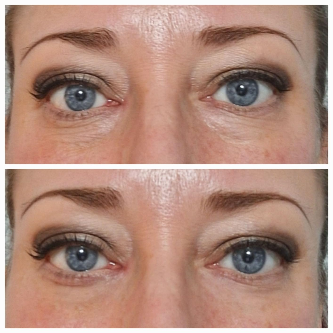 ØjenLys™ Snabb Utjämnare för Ögonområdet